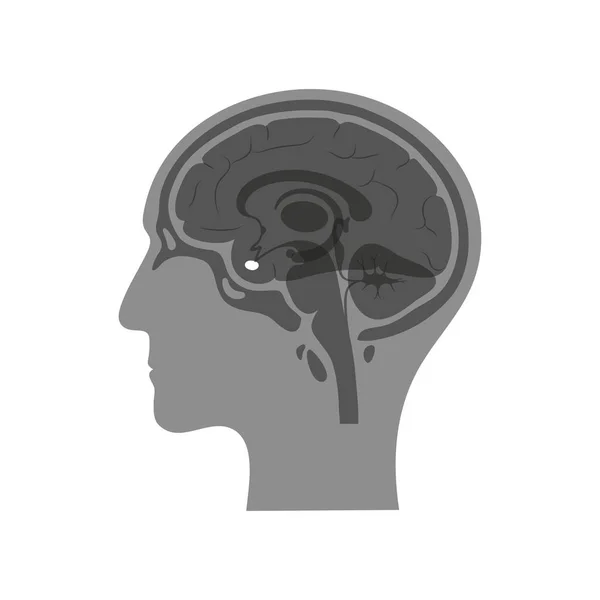 Ilustración aislada vectorial de la glándula pituitaria — Vector de stock
