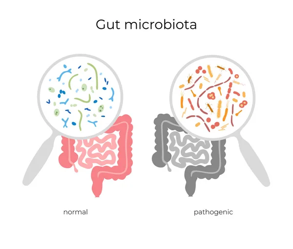 Ilustración vectorial de microbiota humana — Archivo Imágenes Vectoriales