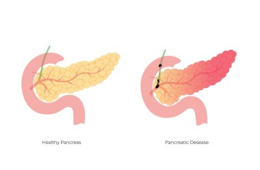 Vector isolated illustration of pancreas clipart