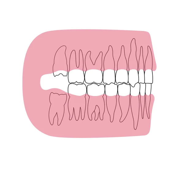 Illustrazione isolata vettoriale del dente — Vettoriale Stock