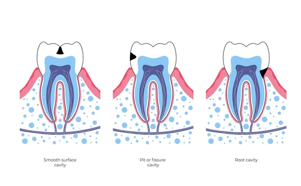 Illustrazione isolata vettoriale del dente — Vettoriale Stock