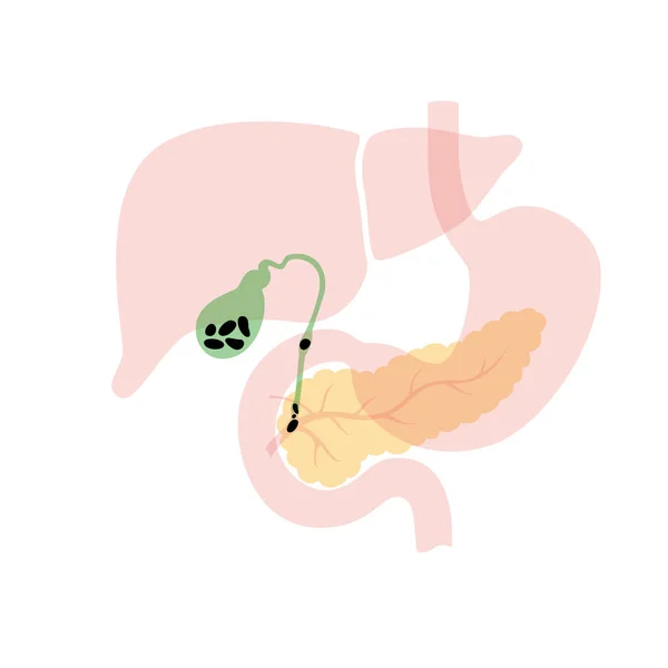 Pancreas and gallbladder — Stock Vector