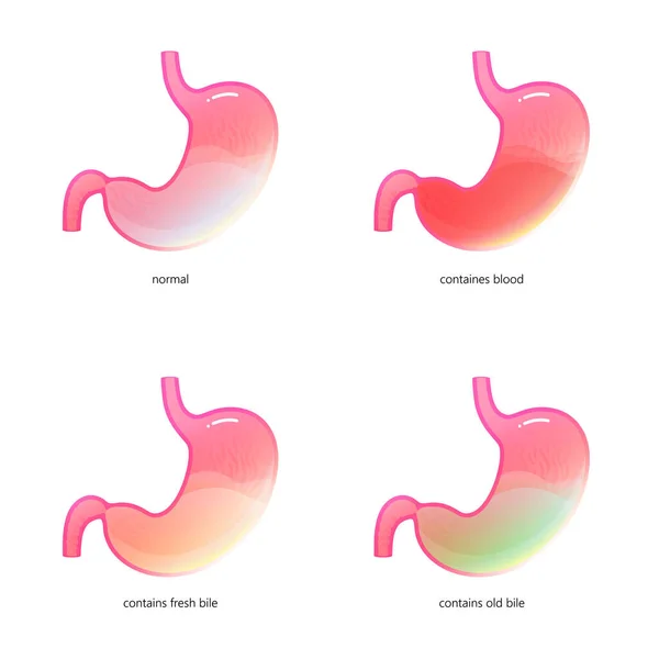 胃のベクトル分離イラスト — ストックベクタ