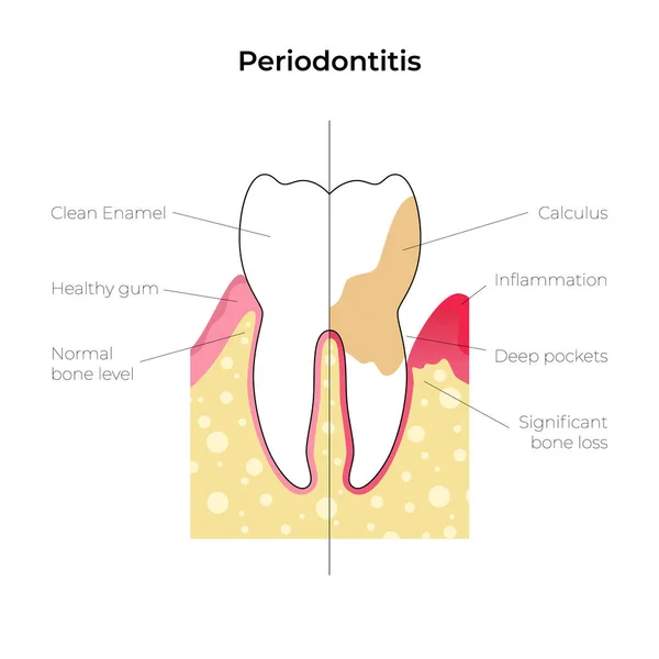 Illustrazione isolata vettoriale del dente — Vettoriale Stock