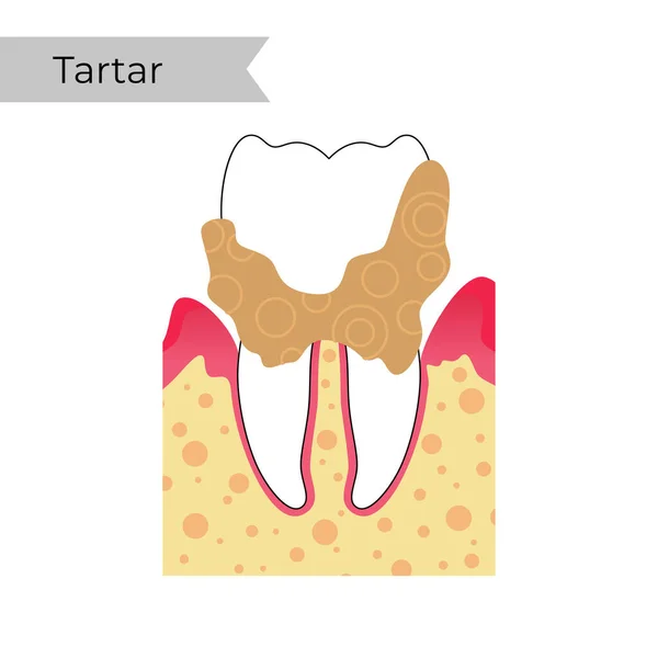 Vektor isolerad illustration av tand — Stock vektor