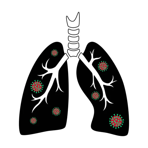 ウイルス感染によるヒト肺 — ストックベクタ