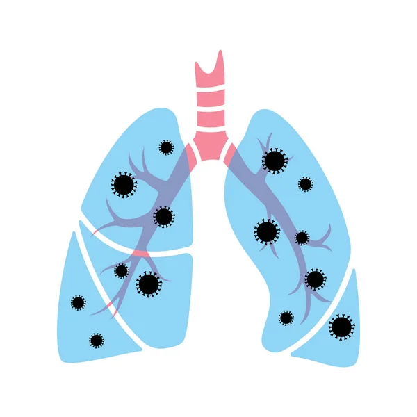 Pulmones humanos con infección por virus — Archivo Imágenes Vectoriales