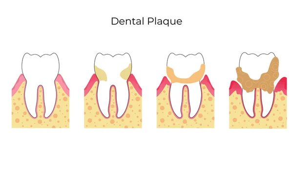 Vector isolated illustration of tooth — Stock Vector