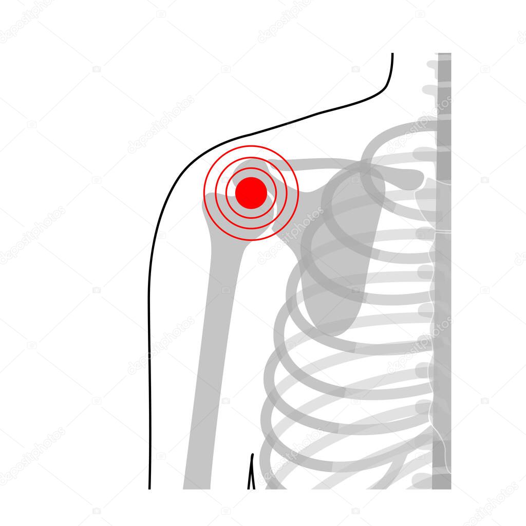 Human shoulder joint pain anatomy.