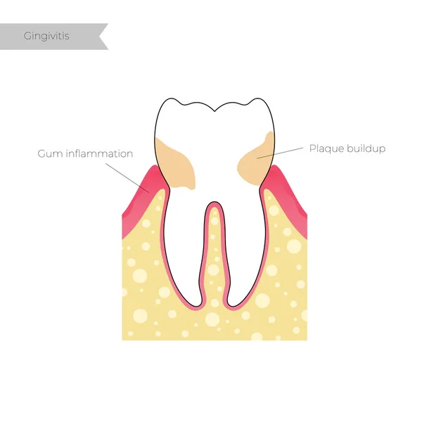 Ilustración aislada vectorial del diente — Vector de stock