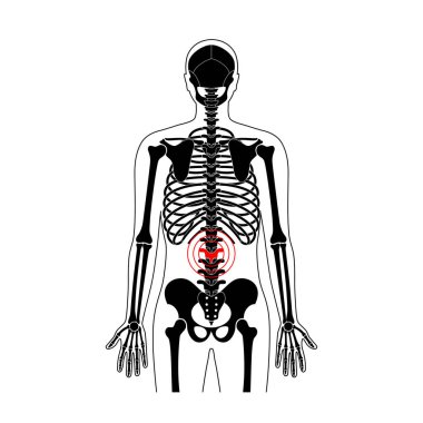 İnsan omurgası acı vektörü çizimi