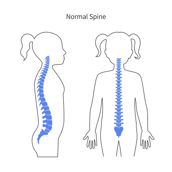 Ragazza sana illustrazione vettore della colonna vertebrale — Vettoriale Stock