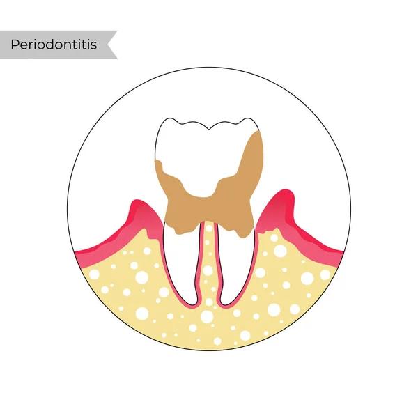 Ilustración aislada vectorial del diente — Archivo Imágenes Vectoriales