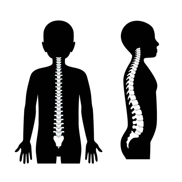 Ragazzo sano vettore della colonna vertebrale illustrazione — Vettoriale Stock