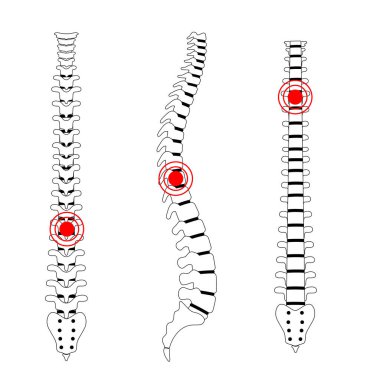 İnsan omurgası acı vektörü çizimi
