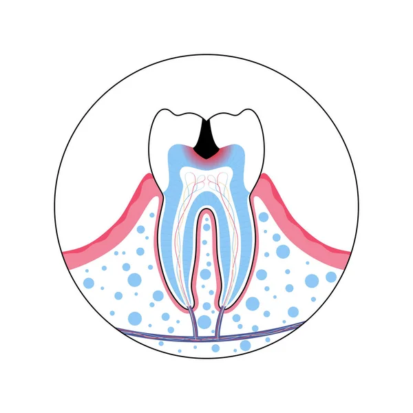 Векторні ізольовані ілюстрації зуба — стоковий вектор