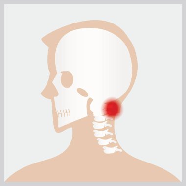 Disease of  head and neck. clipart