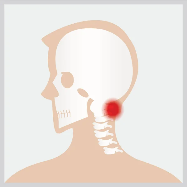Νόσος του κεφαλιού και του λαιμού. — Διανυσματικό Αρχείο