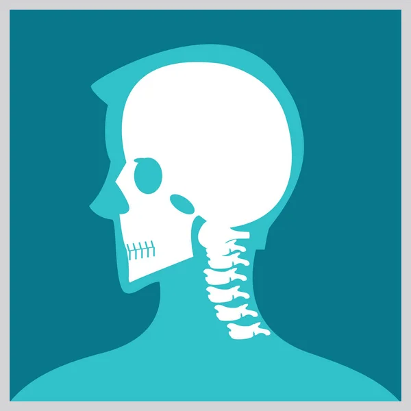 Xray of head and neck. — Stock Illustration Xray of head and neck. Stock Illustration
