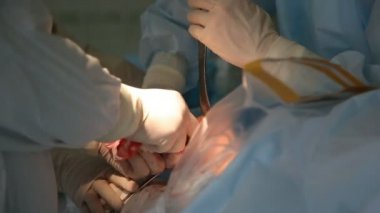 Ortopedik Cerrahlar bir insan HIP Ortopedik Cerrahlar coxal ortak bir operasyon odasında sabitleme ise yara kırmızı büyük araçlar ekleyerek bir büyük kırmızı delik A çarpıcı closeup metalik aletler kullanarak kesmek