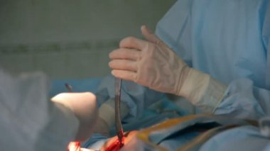 Ortopedik Cerrahlar metalik bir sopa Ortopedik Cerrahlar bir operasyon odasında bir kalça coxal ortak bir tamir ederken insan bacağından büyük bir kırmızı delik yapmak bir büyük kırmızı delik A kanlı closeup kullanılarak bir insan HIP düzeltmek