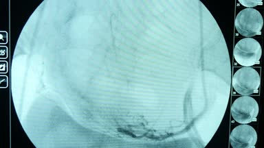 Mamografi büyük bir mavi ekran portre ile inceleme bir büyük yuvarlak ekran ile gelişmiş bir röntgen monitör ve sağlık durumlarına inceleyerek kadınların mamografi için birkaç küçük olanlar için fütüristik Xray inceden inceye gözden geçirmek