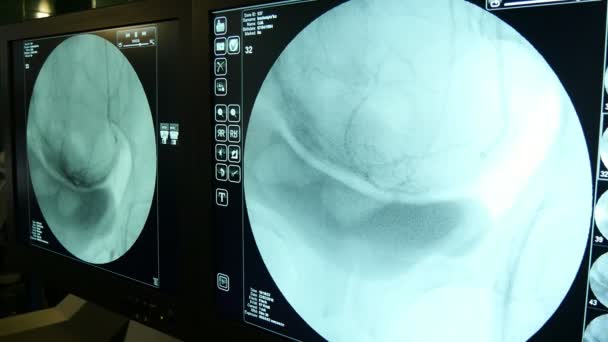 Avancerade Xray Placerade Scanner Med Två Stora Blå Skärmar Diagonalt — Stockvideo