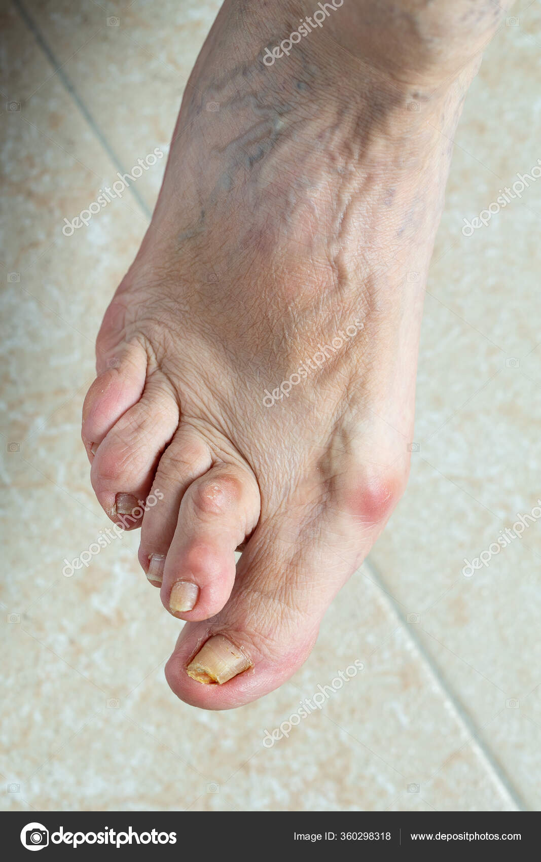 524 Discoloured Stock Photos Images Download Discoloured Pictures On Depositphotos