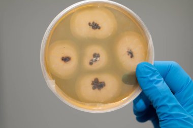 Bakteri kolonili petri kabı