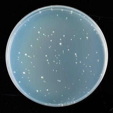 Tarlada yetişen bakteri kolonileri olan bir laboratuvar petri kabı, siyah arka planda izole edilmiş.
