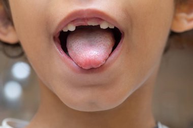 Genç çocuk gururla kayıp süt dişlerini gösteriyor. Bebek dişi kaybı çocukluk büyüme konsepti