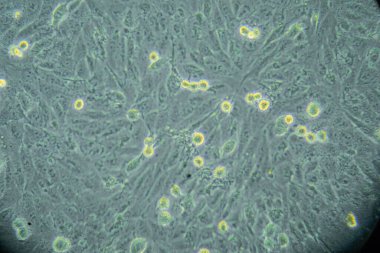 Bakteri kolonisi mikroskop altında petri kabında büyüyor.