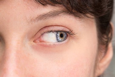 Kız gözü yana bakıyor.