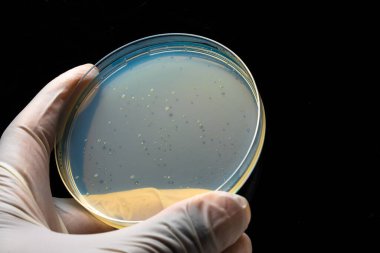 Bakteri kolonileri ya da kalıpları olan bir petri kabı. Mavi katı numuneli yuvarlak laboratuvar ekipmanları beyaz steril eldiven giyiyor. Siyah arka plan. Tıp laboratuarı, tıbbi cam kaplama konsepti.