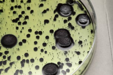 Petri kabındaki bakteri kolonisinin kapanışı