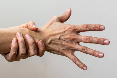 Psikiyatrik bozukluk çeken bir deneğin elleri. Şizofreni ve çift kişilik kavramı