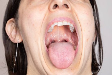 Dili dışarı çıkmış, ağzı açık bir kadının yakın çekimi.