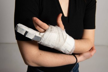 Close up of woman hand in white wrist bandage with steel fixation of broken finger. Stress fracture or repetitive strain injury in hand. Accidents and health care concept clipart