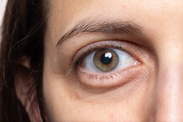 Macro Bolsas Bajo Los Ojos Signo Cansancio Agotamiento Físico — Foto de Stock