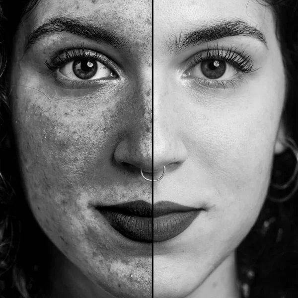 Monochromatic Collage Comparing Close Applying Ultraviolet Light Filter Detect Skin — Stock Photo, Image