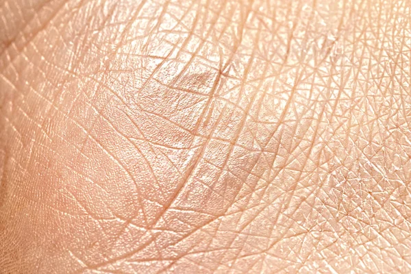 Pele Seca Rachada Closeup Senhora Branca Reidratação Rejuvenescer Conceito Tratamento — Fotografia de Stock