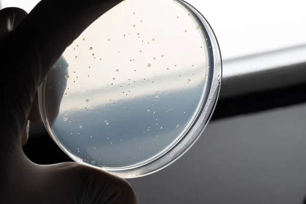 带有细菌菌落或霉菌的实验室玻璃器皿 在手拿着的Petri盘中观察样品 戴白色无菌手套 在光线下观看医疗实验室 医疗玻璃器皿概念 — 图库照片