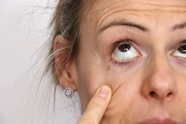 Closeup Young Woman Checking Her Right Eye Eye Problem Health — Stock Photo, Image