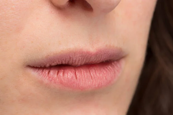 Macro Cracked Dry Lips Young Woman — Stock Photo, Image