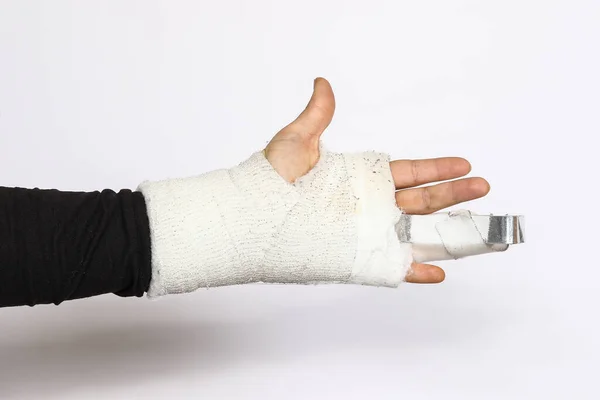 Skadad Bruten Hand Vitt Handledsbandage Med Stålfixering Stukning Spänningsfraktur Eller — Stockfoto