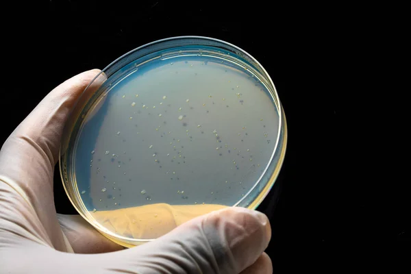 Petrischaal Met Bacteriële Kolonies Schimmels Ronde Laboratoriumapparatuur Met Blauw Massief — Stockfoto