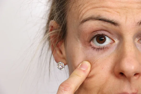 Close View Woman Face Female Stretching Skin Eye Her Finger — Stock Photo, Image