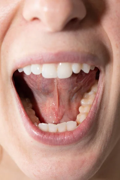 Closeup Woman Open Mouth — Stock Photo, Image