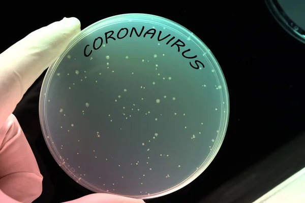 Coronavirus Petri Dish Conceptual Image Laboratory Analysis Risk Contagion — Stock Photo, Image