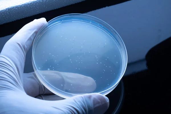 Ronde Laboratoriumapparatuur Met Bacteriële Kolonies Schimmels Blauw Vast Monster Petrischaaltje — Stockfoto